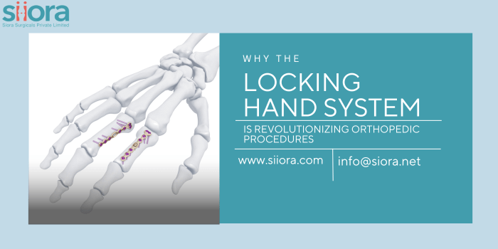 Locking Hand System is Revolutionizing Orthopedic Procedures