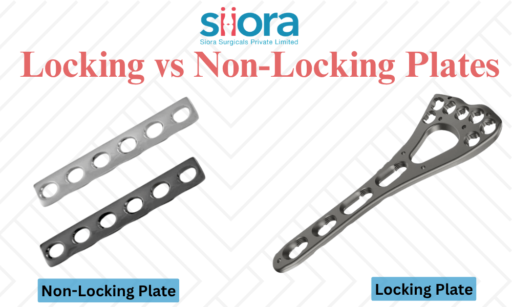 Locking vs Non-Locking Plates