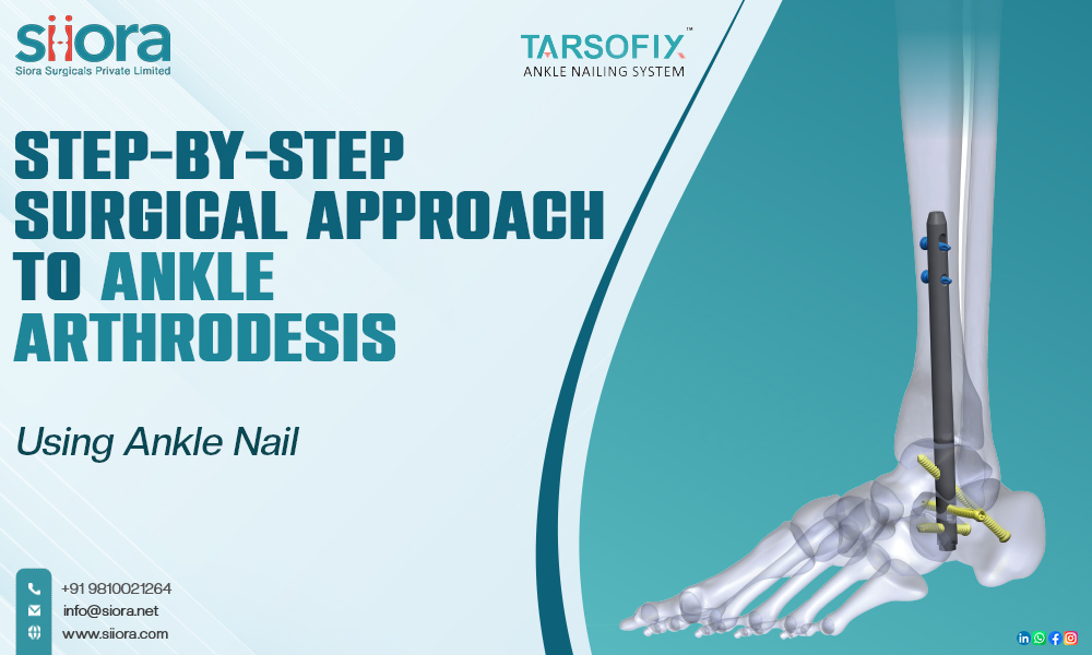 Step-by-Step Surgical Approach to Ankle Arthrodesis Using Ankle Nail