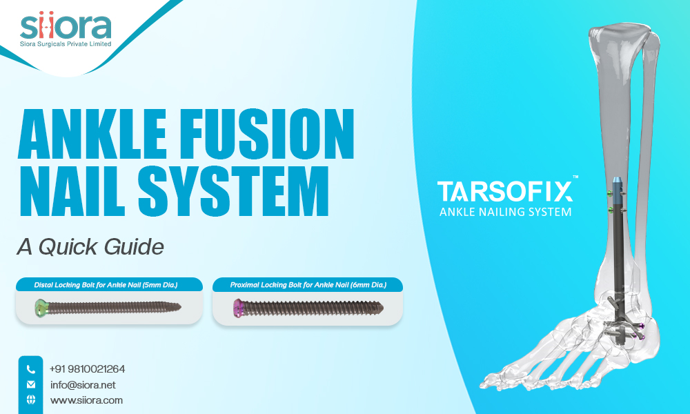 Ankle Fusion Nail System
